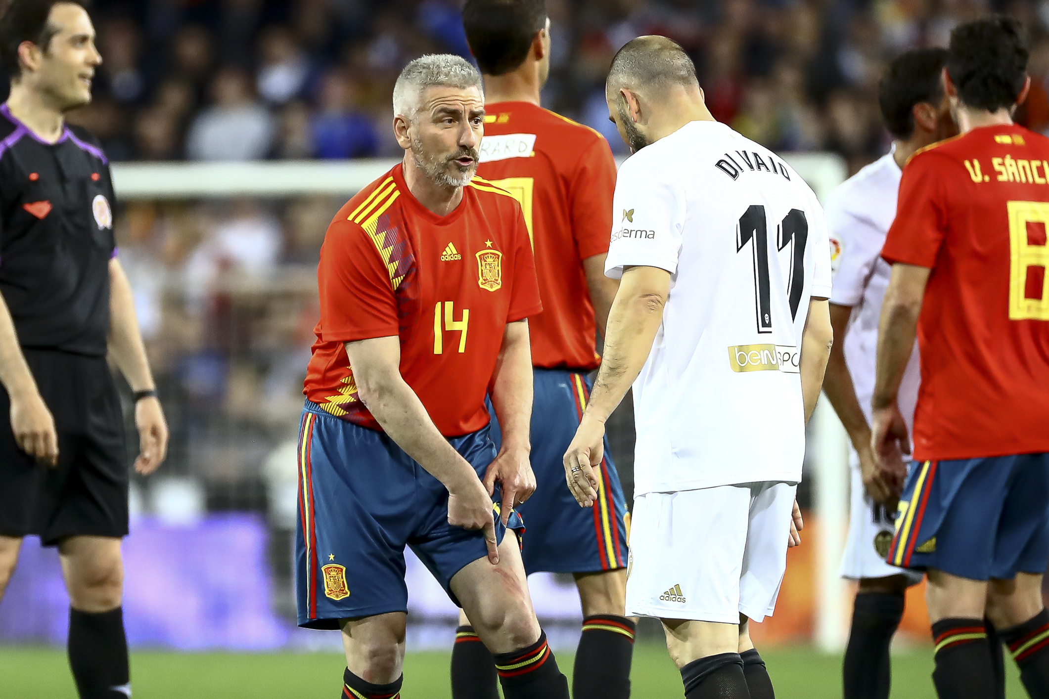 أوتيرو يعرض خدشاً في فخذه الأيسر لدي فايو بعد مباراة الأساطير